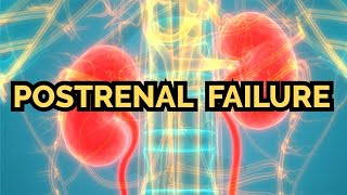 Postrenal Failure updated 2023  CRASH Medical Review Series [upl. by Wilkens357]