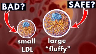 LDL size and Heart Disease small dense vs large quotfluffyquot  Dr William Cromwell [upl. by Berkeley921]