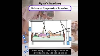 Balanced Suspension Traction nclex nursingexam exam nclexready nclexpracticequestions [upl. by Ahcurb]