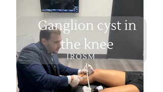 What is a ganglion cyst in the knee [upl. by Ahsitnauq]