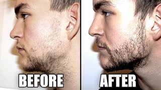 Trying a Beard Growth Kit for 2 Months  My RESULTS  CPH Grooming Review [upl. by Setiram]