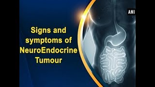 Signs and symptoms of NeuroEndocrine Tumour  ANI News [upl. by Corin765]