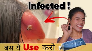 How to Heal Infected Ear Piercing Faster  100 Result  Ravinaa Gupta [upl. by Jennica]