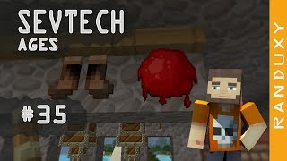 SevTech Ages Minecraft  Ep35  Coagulated Blood and Boots of Escaping “Wild Dog Pelt Boots” [upl. by Heintz]