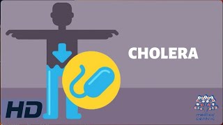 CHOLERA Everything You Need To Know [upl. by Servais211]