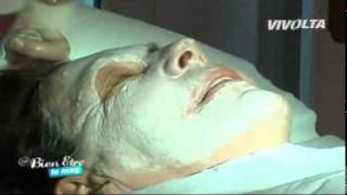 Les peelings du visage quotChirurgie Esthétique Tunisiequot [upl. by Lanfri]