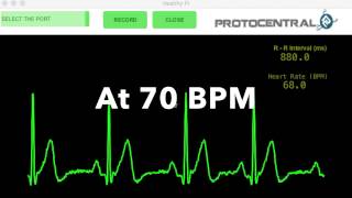 ProtoCentral HeartyPatch initial testing [upl. by Nauh379]