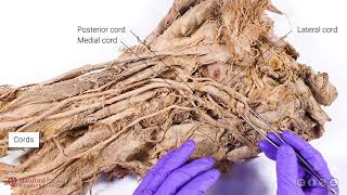 Brachial Plexus and Axillary Artery [upl. by Ellebyam699]