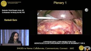 Laparoscopic liver resection for hepatocellular carcinoma located in segment 7 or 8 [upl. by Eirrek]