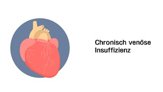 Chronisch venöse Insuffizienz CVI  Erkrankungen der Gefäße und des Kreislauf [upl. by Ayardna374]