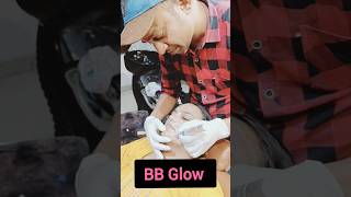 BB Glow Treatment  Microneedling Healing Process  BB Glow Facial Treatment [upl. by Steven]