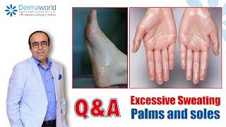 QnA with Dr Rohit Batra  Excessive Sweating Palms and soles  Hyperhidrosis Treatment  In Hindi [upl. by Adriaens]