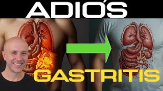 CURA tu GASTRITIS ¡Con estos pasos [upl. by Leffert]