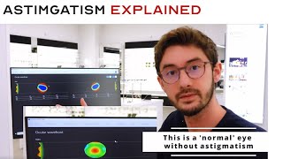 What is Astigmatism The ONLY Video You Need to Watch  What is CYL  Your Prescription Explained [upl. by Asnerek379]