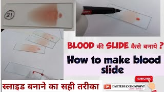 blood की slide कैसे बनाये slide kaise bnaye  HematologyMaking a paripheral Blood smear slide [upl. by Westphal49]