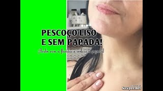 NECKLINE SLIMMER E ACABE COM A FLACIDEZ NO PESCOÇO E PAPADA [upl. by Accebor]