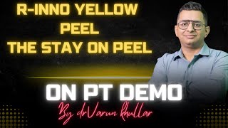 RINNO YELLOW PEEL STAY ON PEEL FOR GLOW On patient demo by DR VARUN KHULLAR MBBS MD [upl. by Abibah]