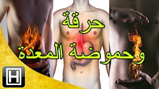 علاج حرقة المعدة والحموضة طبيعيا وبأفضل وأسهل الوصفات [upl. by Sherer]