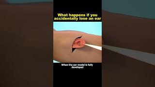 What if you accidentally lose your ear 👂  is it attachable youmustknow humanear [upl. by Neelak]