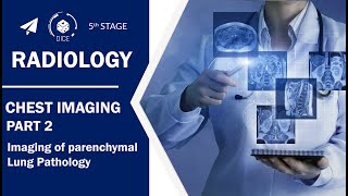 Radiology  Chest Imaging 2  Imaging of parenchymal Lung Pathology [upl. by Erihppas]