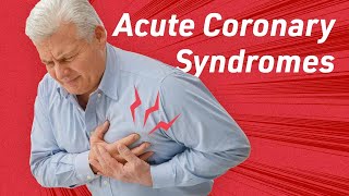 Differential Diagnosis for Acute Coronary Syndrome [upl. by Odele]