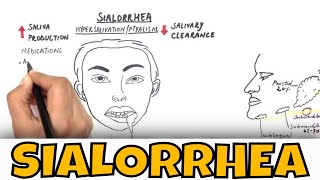 Sialorrhea  Drooling  Causes Clinical features and Treatment [upl. by Krongold]