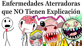 Enfermedades Más Aterradoras que la Ciencia NO Puede Explicar [upl. by Nna36]