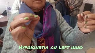 hypokinesia testing in Parkinsons Diseasedoctor sathi [upl. by Enert]