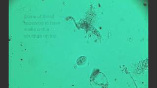 amoeba dictyostelium spore release [upl. by Arramahs]