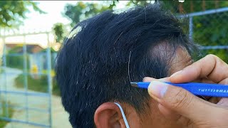 pulling out the white hair removal for Mr 6cong asmr [upl. by Yrnehnhoj]