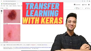 Transfer Learning Using CNNVGG 16 Keras Tutorial [upl. by Yhpos]