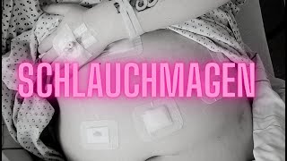 Schlauchmagen Operation  Sleevop Leben 20 [upl. by Elleimac542]