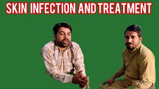 skin infection skin infection medicinedr Allah rakhaskininfection [upl. by Nrevel]