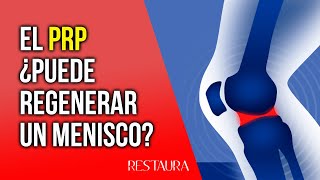 El PRP ¿Puede regenerar un menisco [upl. by Arrais565]