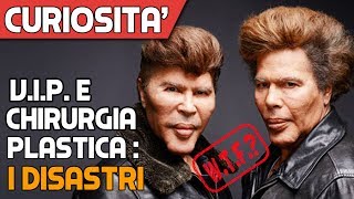 I DISASTRI Celebrità Prima e Dopo la Plastica Estrema [upl. by Rosabel]