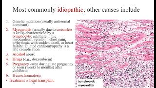 Lecture 7 Cardiomyopathy Cardiac tumors [upl. by Sukcirdor]