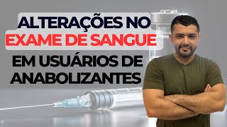 Exame de sangue e anabolizante é isso que pode acontecer [upl. by Atiuqin]