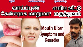 அனைத்து விதமான தீராத வாய்ப்புண் வாய் துற்நாற்றம் முழு தீர்வு l MOUTH ULCER NATURAL REMEDY in TAMIL [upl. by Douty]