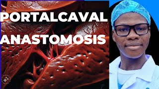 Portalcaval anastomosis Indication liver physiology and complications of the procedure [upl. by Ynohtnaluap]