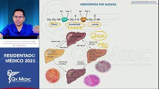 Gastroenterología  13 Hepatopatias por Alcohol [upl. by Erdnuaed]