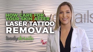 How to Care for Skin After Laser Tattoo Removal  Body Details [upl. by Velick484]