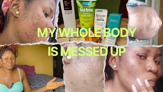 DEALING WITH HORMONAL IMBALANCE 😫  FACIAL PROCEDURE amp PRODUCT REVIEW  ACNE TREATMENT [upl. by Gail773]