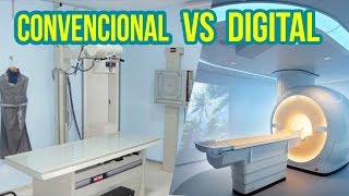 RADIOLOGIA CONVENCIONAL VS DIGITAL [upl. by Khan]