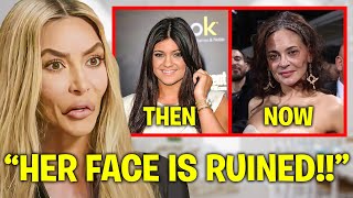 Kim Kardashian EXPOSES Kylie Jenner’s BOTCHED Plastic Surgery [upl. by Sgninnej]