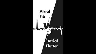 Atrial Fibrillation vs Atrial Flutter on EKG [upl. by Lucila]