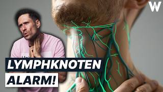 Unbekannte Knubbel Gefährlich von harmlos unterscheiden Wichtigsten Fakten zu großen Lymphknoten [upl. by Paget761]