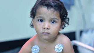 Healing the Children Cleft Lip and Palate Surgery [upl. by Stuart]