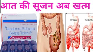 MesacalOD Mesalamine prolonged release in hindi Use Profit Sideeffects by offlineboymedico [upl. by Engracia]