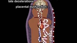 Fetal Heart Rate Monitoring Review FHR by Dr Cal Shipley MD [upl. by Hosea]