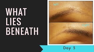 Microblading Day 5What Lies Beneath Pigment Fading [upl. by Isidora79]